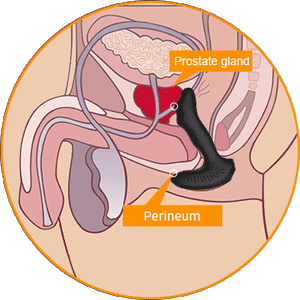 Prostate Orgasms - A level of sexual pleasure you didn't think possible.